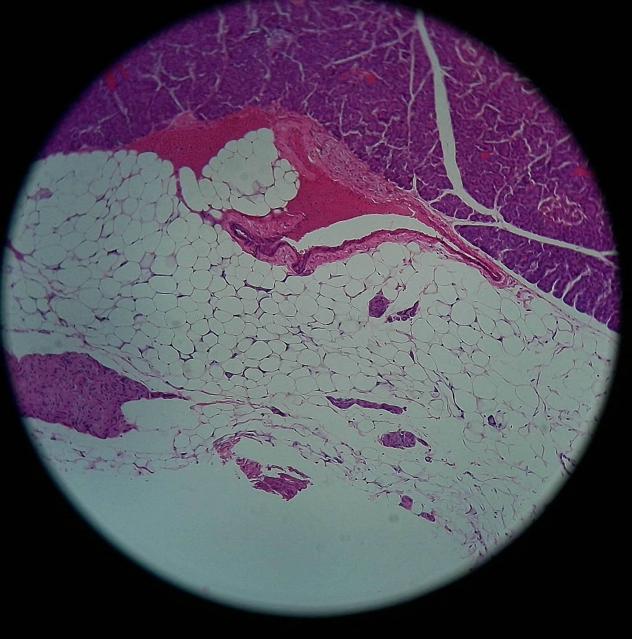 胰腺示胰岛切片(03).jpg