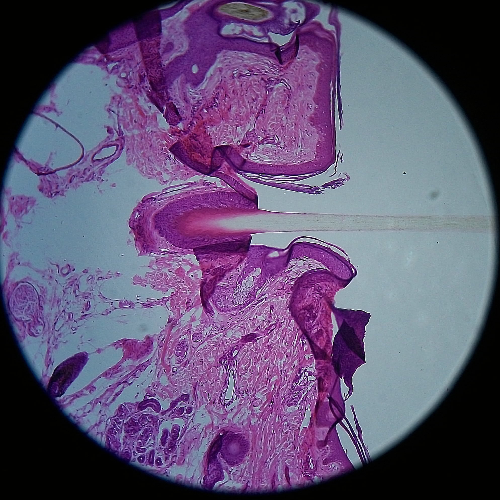 人皮过毛囊切片(02).jpg