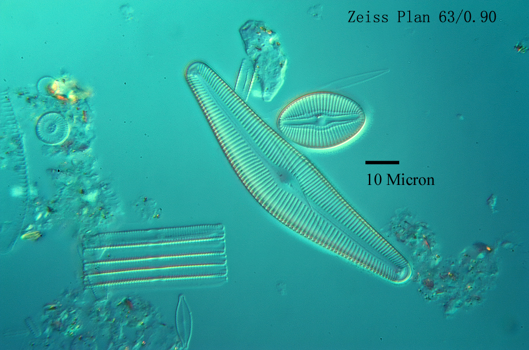 北方硅藻-diatom1s.jpg