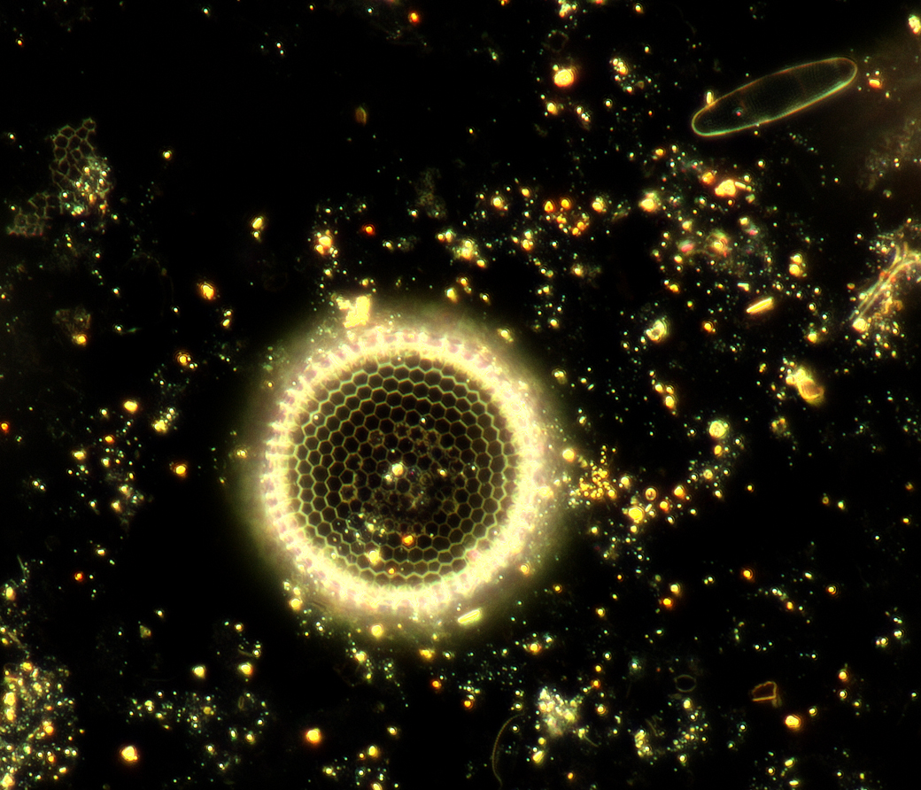 diatom1 darkfield.jpg