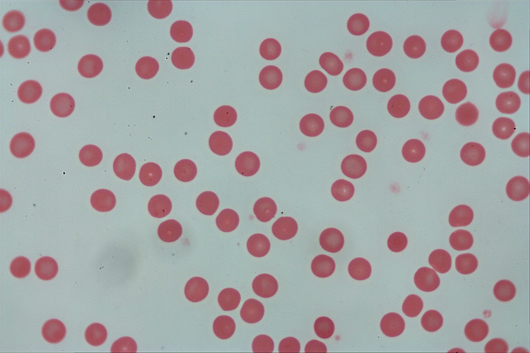 人血细胞涂片60X-NA0.95-whitefield.jpg