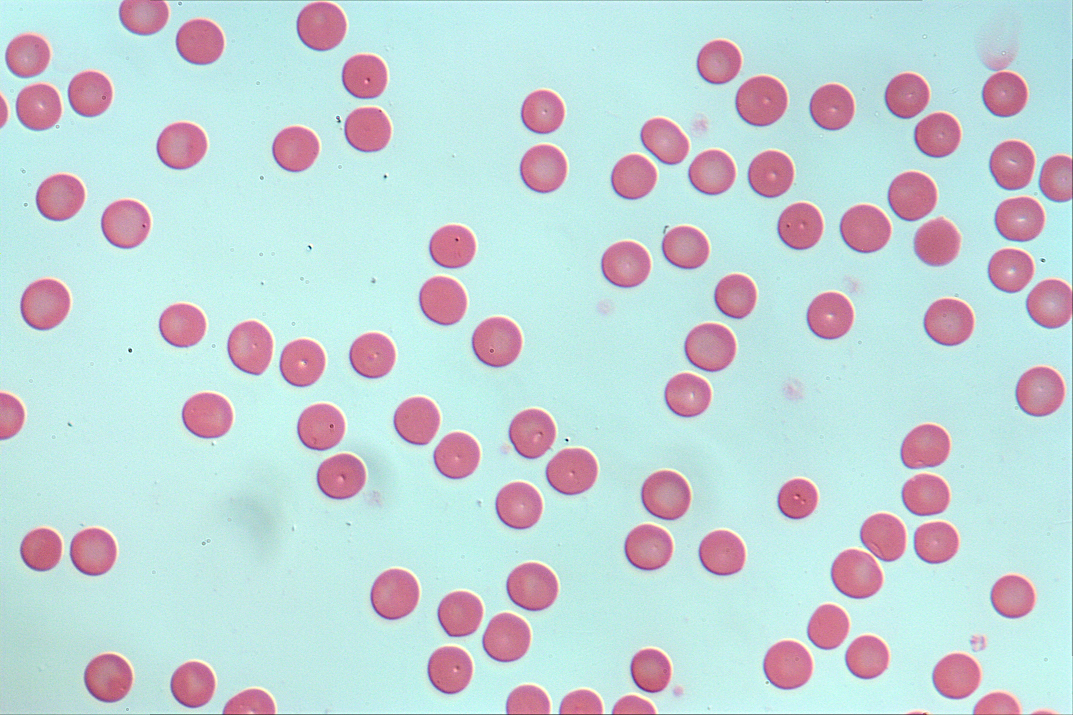 人血细胞涂片60X-NA0.95-DIC.jpg