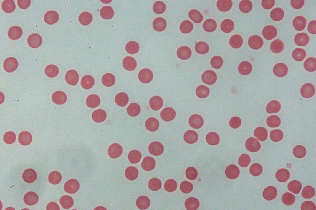人血细胞涂片40X-NA0.65-whitefield.jpg