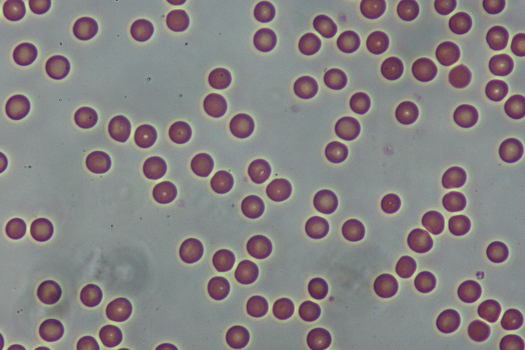 人血细胞涂片40X-NA0.65-PL phase.jpg