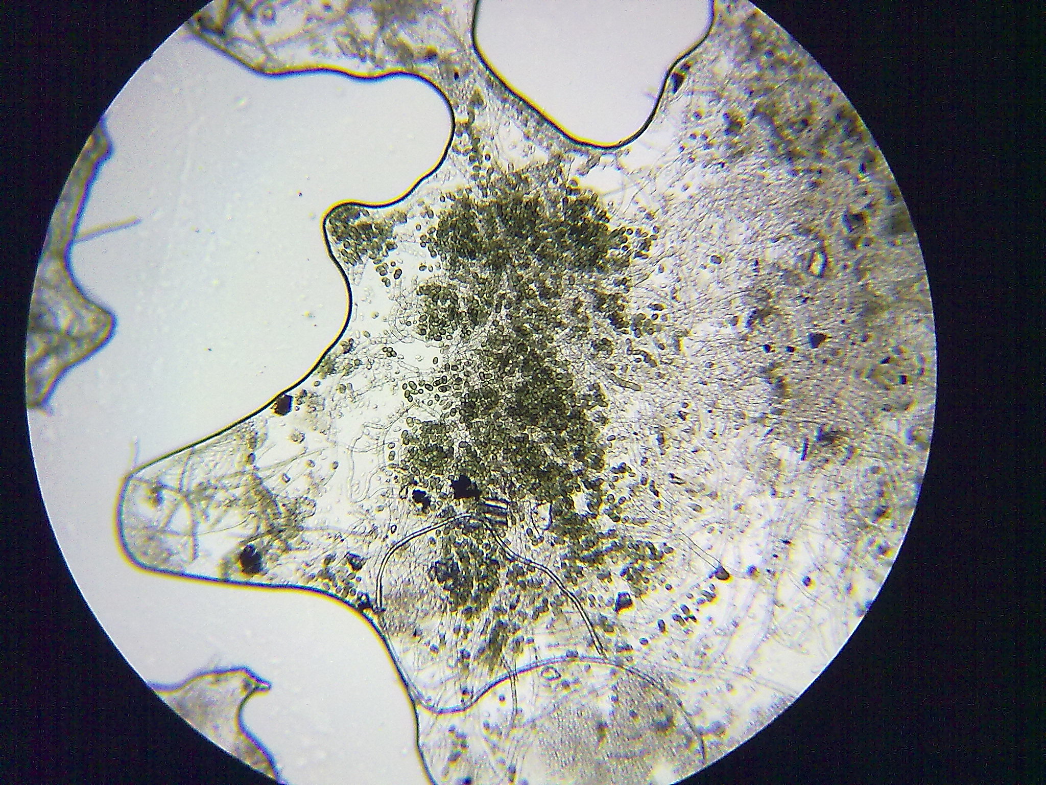 毛霉显微镜下形态特征图片