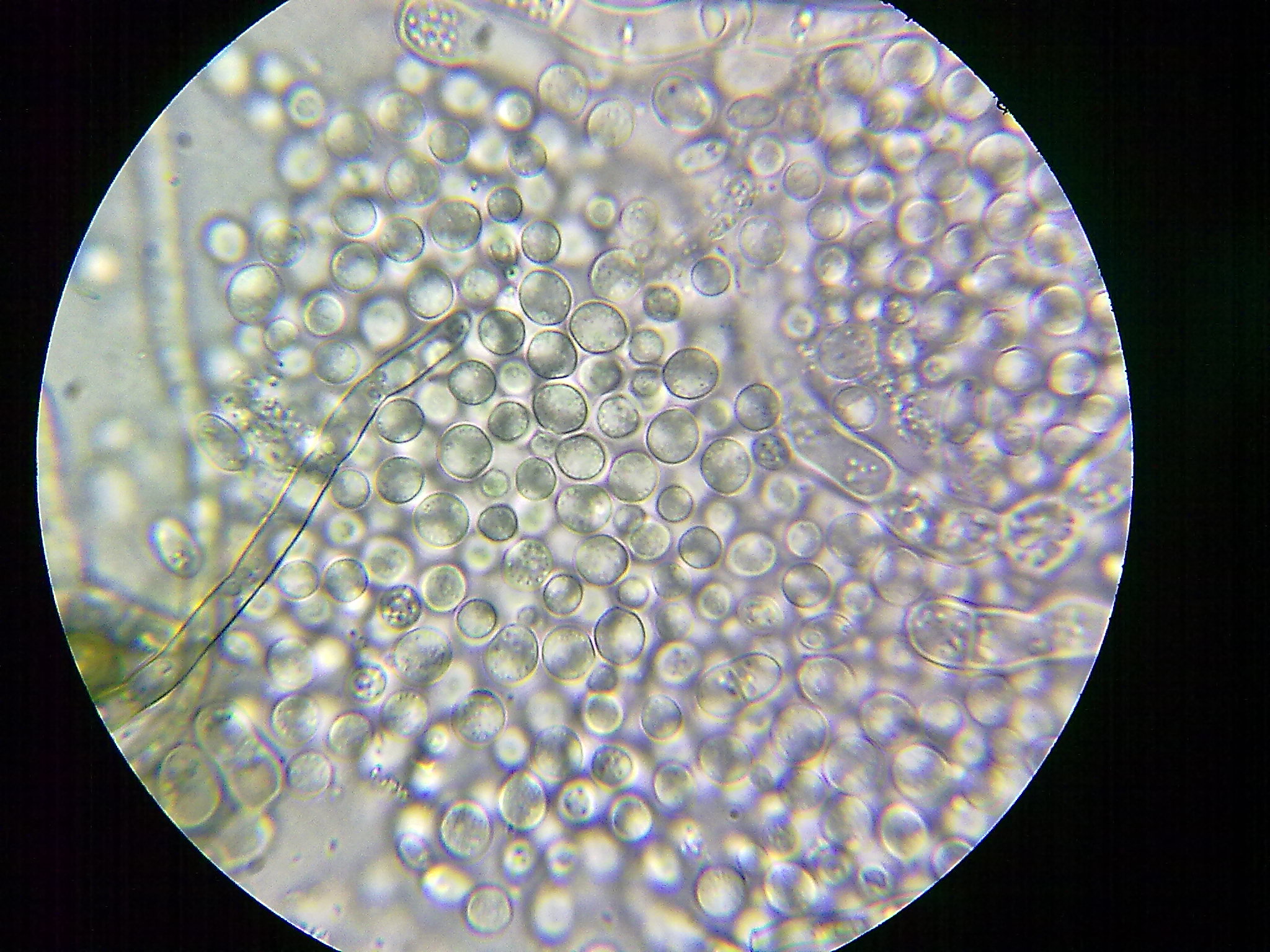 霉菌显微镜下图片