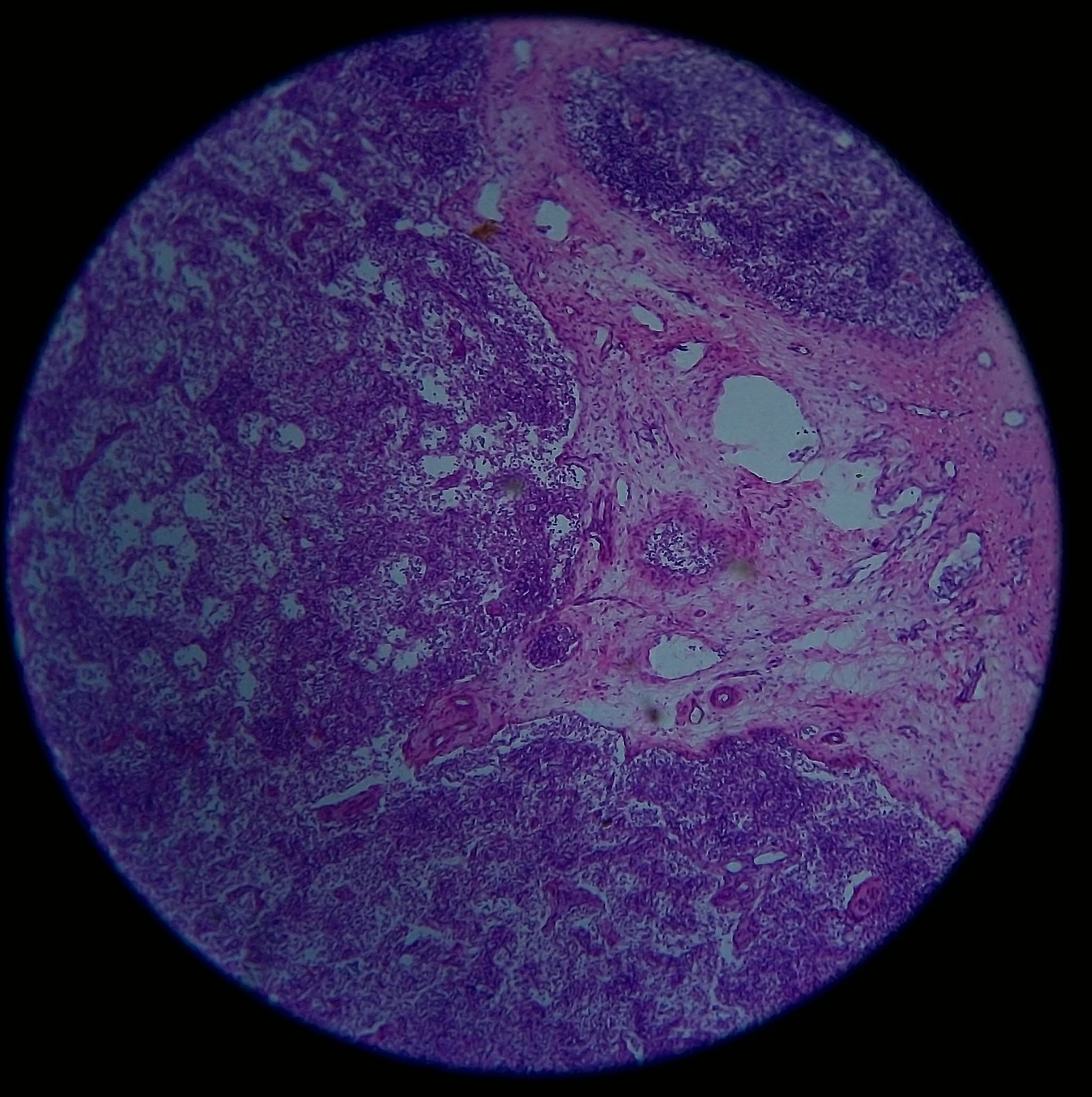淋巴结显微镜结构图图片