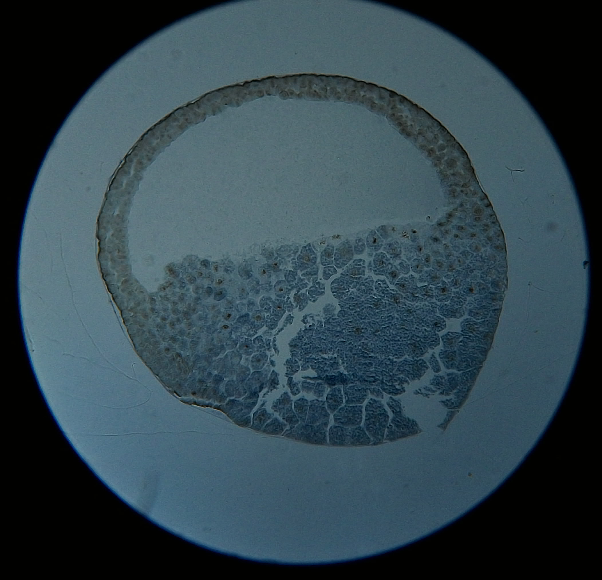 蛙囊胚早期切片图片