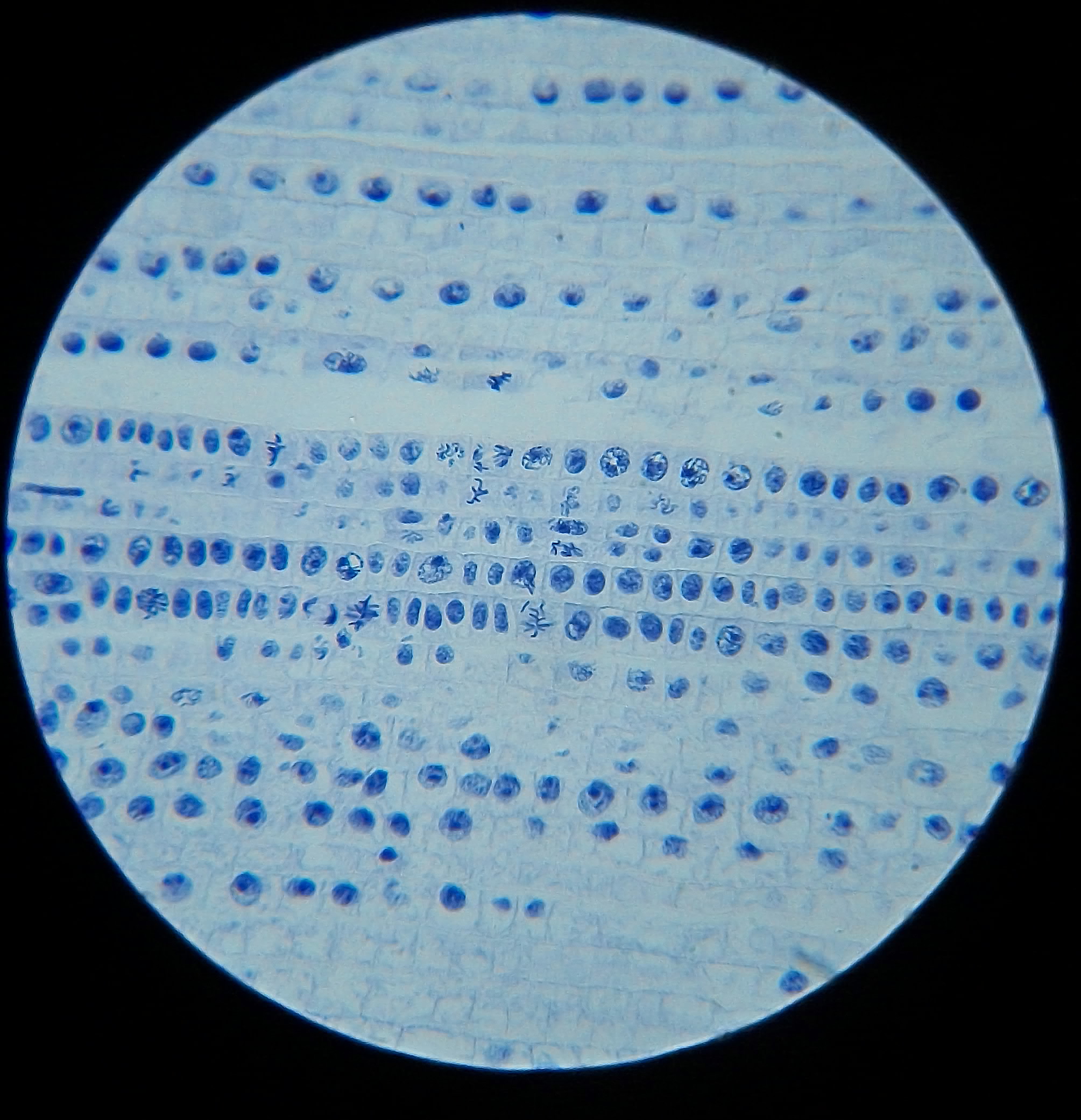 洋葱根尖染色体手绘图图片