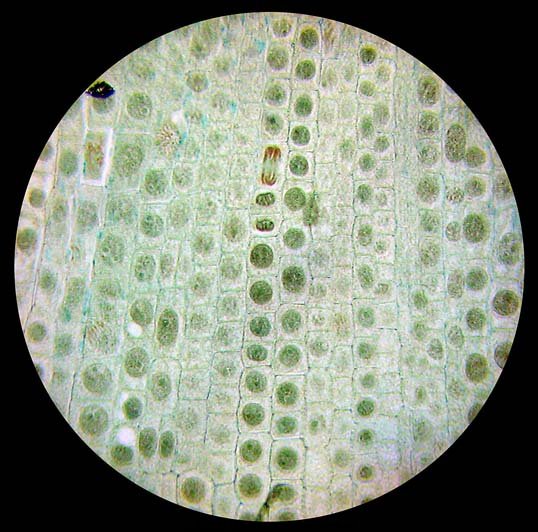 洋葱根尖细胞前期图片
